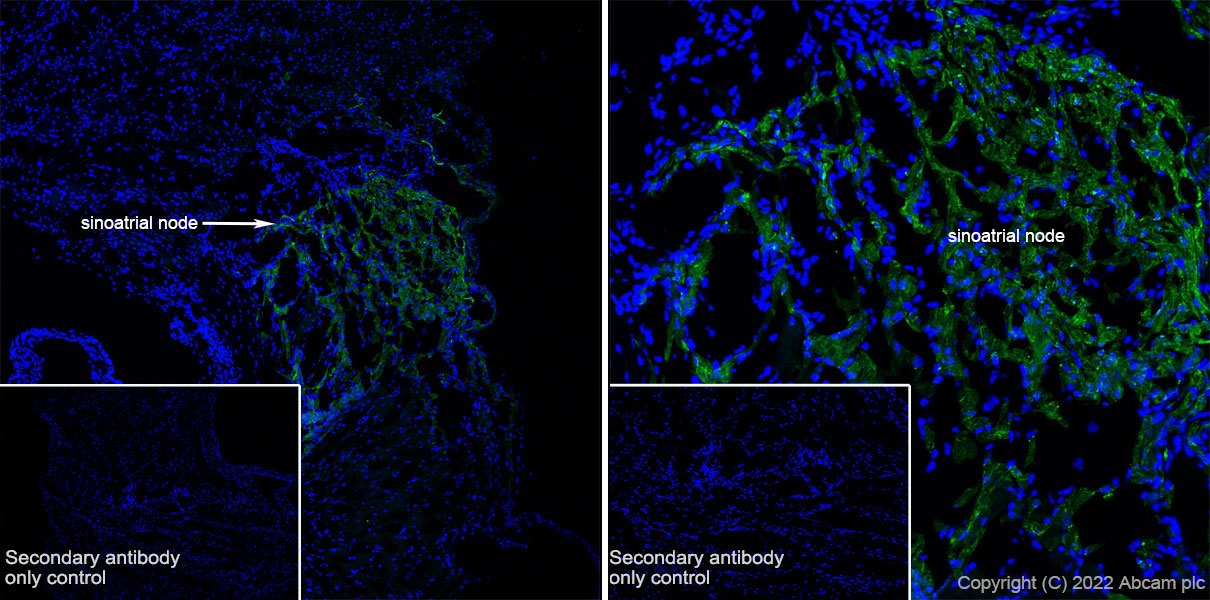 Immunohistochemistry (Frozen sections) - Anti-HCN4 antibody [EPR25291-44] - BSA and Azide free (AB289985), expandable thumbnail