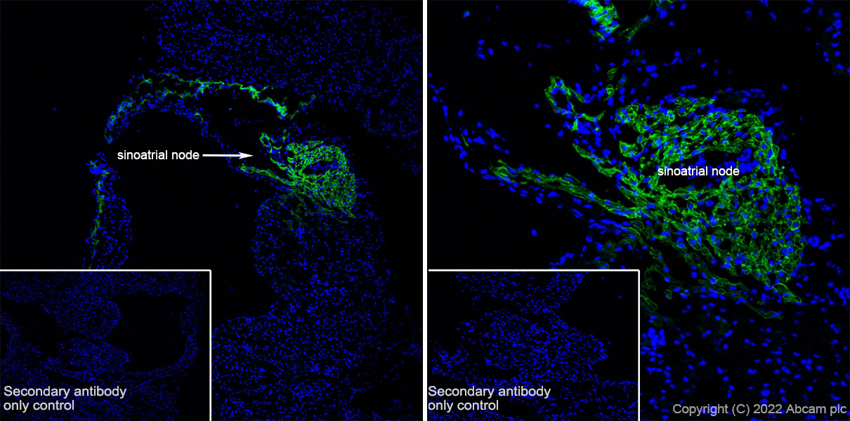 Immunohistochemistry (Frozen sections) - Anti-HCN4 antibody [EPR25291-44] - BSA and Azide free (AB289985), expandable thumbnail