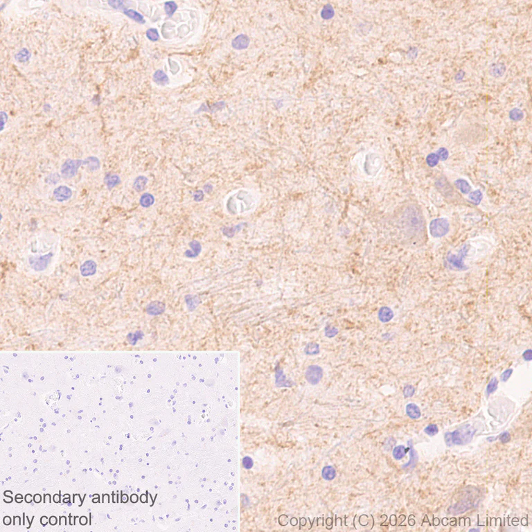 Immunohistochemistry (Formalin/PFA-fixed paraffin-embedded sections) - Anti-HCN4 antibody [EPR30362-531] (AB327083)