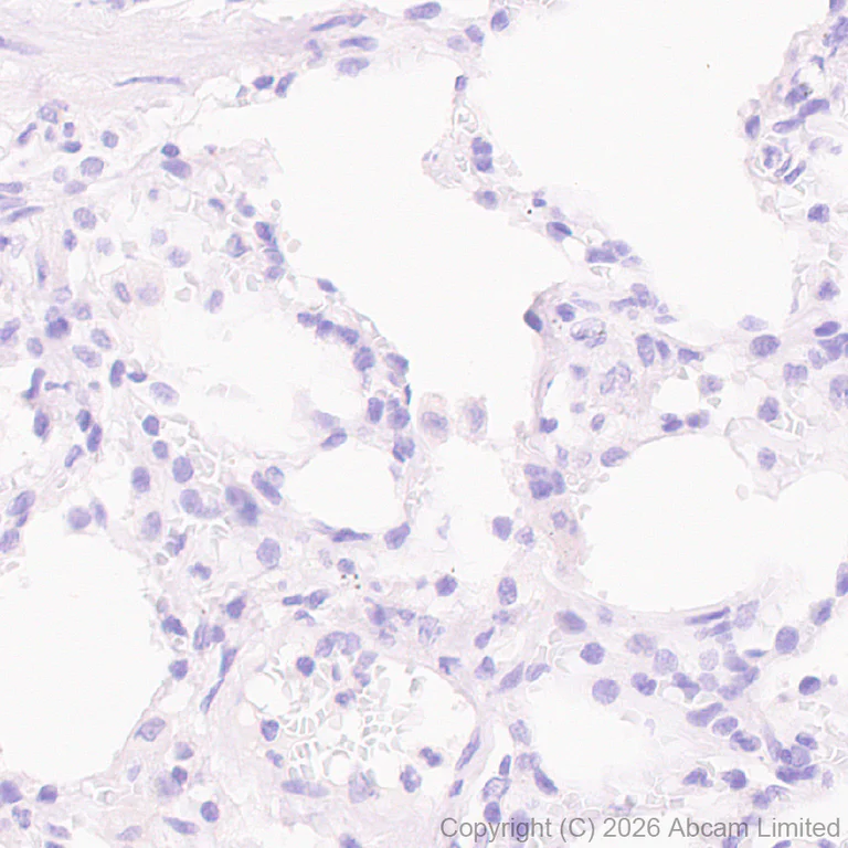 Immunohistochemistry (Formalin/PFA-fixed paraffin-embedded sections) - Anti-HCN4 antibody [EPR30362-531] (AB327083)