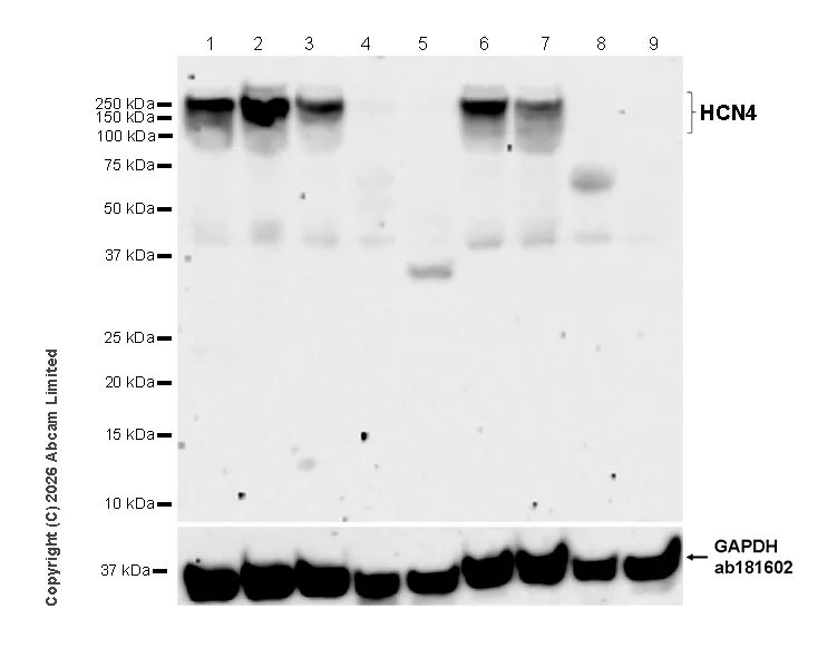 Western blot - Anti-HCN4 antibody [EPR30362-531] (AB327083)