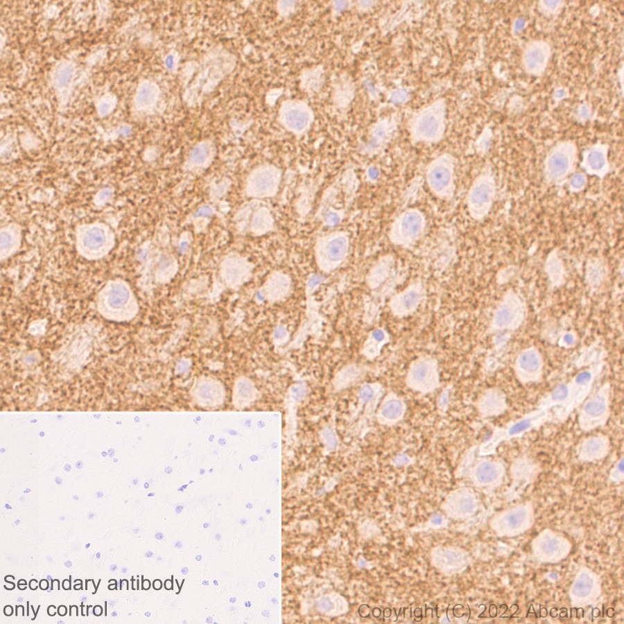Immunohistochemistry (Formalin/PFA-fixed paraffin-embedded sections) - Anti-HCN4 antibody [N114/10] (AB302675), expandable thumbnail