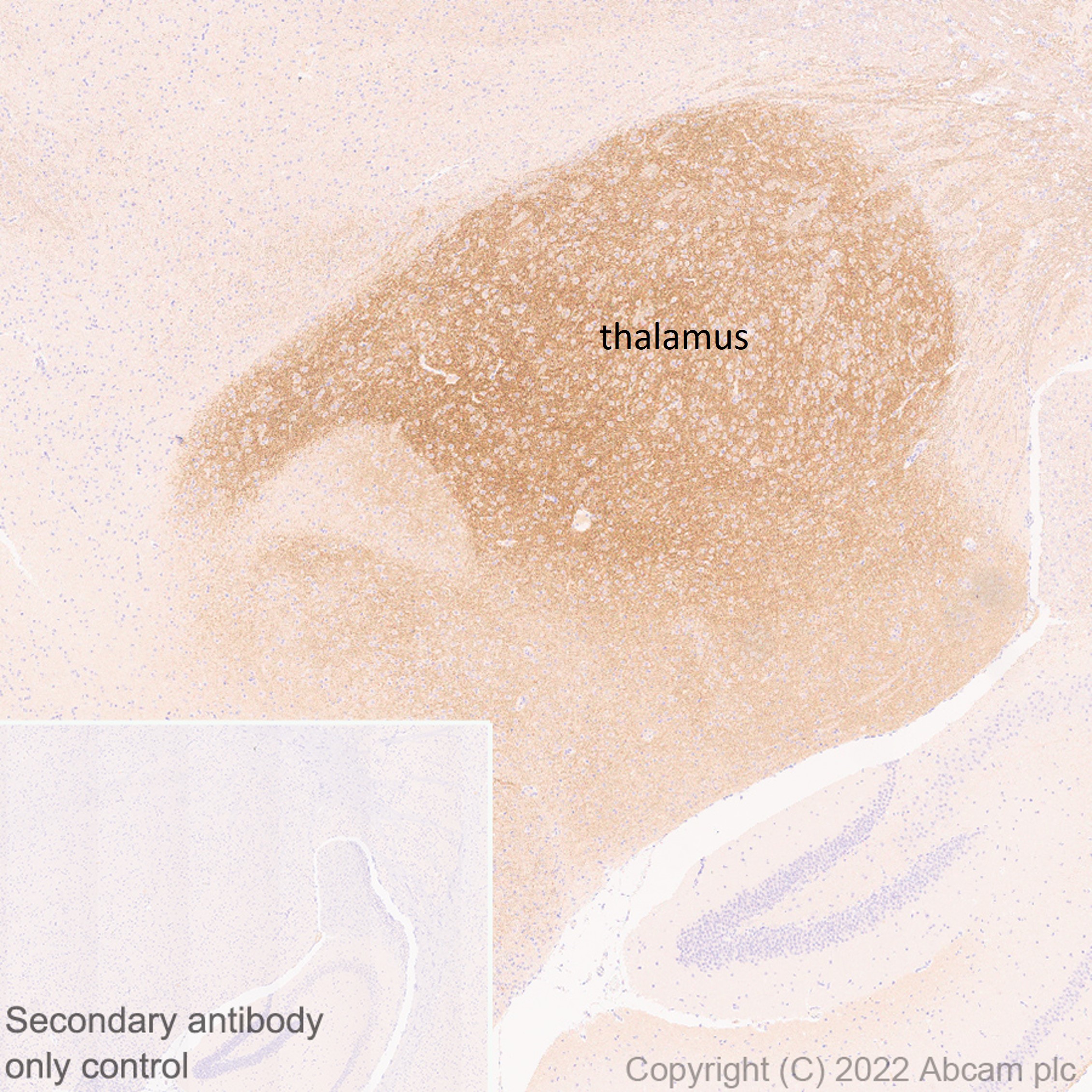Immunohistochemistry (Formalin/PFA-fixed paraffin-embedded sections) - Anti-HCN4 antibody [N114/10] (AB302675), expandable thumbnail