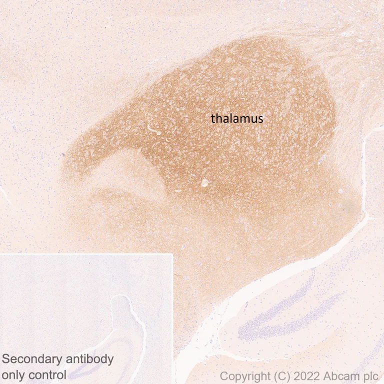 Immunohistochemistry (Formalin/PFA-fixed paraffin-embedded sections) - Anti-HCN4 antibody [N114/10] (AB302675)