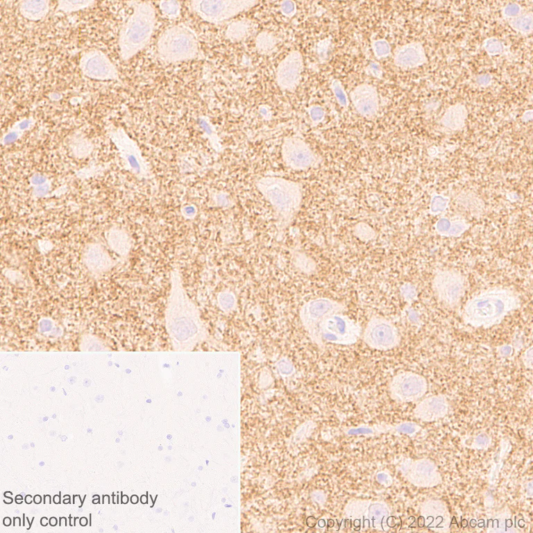 Immunohistochemistry (Formalin/PFA-fixed paraffin-embedded sections) - Anti-HCN4 antibody [N114/10] (AB302675)