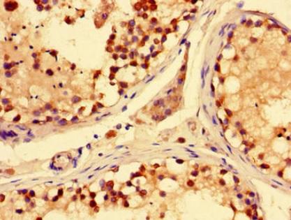 Immunohistochemistry (Formalin/PFA-fixed paraffin-embedded sections) - Anti-hCNT3 antibody (AB223085)