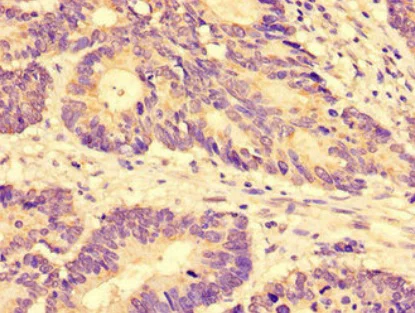Immunohistochemistry (Formalin/PFA-fixed paraffin-embedded sections) - Anti-hCNT3 antibody (AB223085)