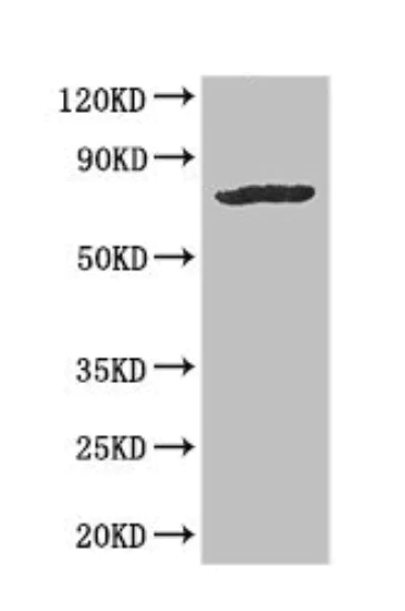 Western blot - Anti-hCNT3 antibody (AB223085)
