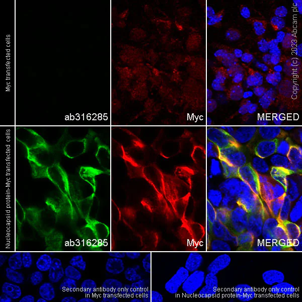 Immunocytochemistry/ Immunofluorescence - Anti-HCoV-229E Nucleocapsid protein antibody [abd210] - BSA and Azide free (AB316286)