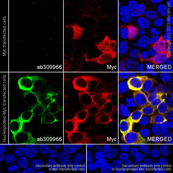 Immunocytochemistry/ Immunofluorescence - Anti-HCoV-OC43 Nucleoprotein antibody [abd385] - BSA and Azide free (AB309967)