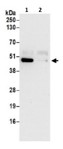 Immunoprecipitation - Anti-HCP1/PCFT antibody (AB241949)
