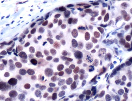 Immunohistochemistry (Formalin/PFA-fixed paraffin-embedded sections) - Anti-HDAC1 antibody - C-terminal (AB231487)