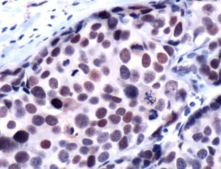Immunohistochemistry (Formalin/PFA-fixed paraffin-embedded sections) - Anti-HDAC1 antibody - C-terminal (AB231487)