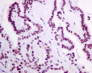 Immunohistochemistry (Formalin/PFA-fixed paraffin-embedded sections) - Anti-HDAC1 antibody [EPR5517(2)] - BSA and Azide free (AB248968)
