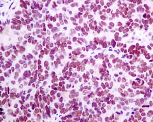 Immunohistochemistry (Formalin/PFA-fixed paraffin-embedded sections) - Anti-HDAC1 antibody [EPR5517(2)] - BSA and Azide free (AB248968)