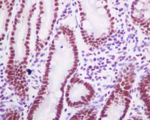 Immunohistochemistry (Formalin/PFA-fixed paraffin-embedded sections) - Anti-HDAC1 antibody [EPR5517(2)] - Nuclear Loading Control (ab150399), expandable thumbnail