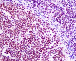 Immunohistochemistry (Formalin/PFA-fixed paraffin-embedded sections) - Anti-HDAC1 antibody [EPR5517(2)] - Nuclear Loading Control (ab150399), expandable thumbnail