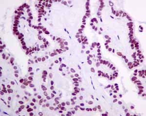 Immunohistochemistry (Formalin/PFA-fixed paraffin-embedded sections) - Anti-HDAC1 antibody [EPR5517(2)] - Nuclear Loading Control (ab150399), expandable thumbnail