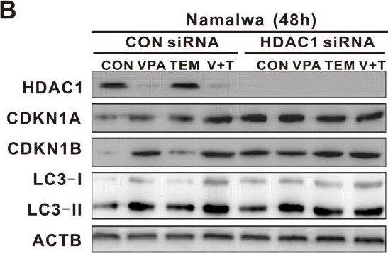 Western blot - Anti-HDAC1 antibody [EPR5517(2)] - Nuclear Loading Control (ab150399), expandable thumbnail