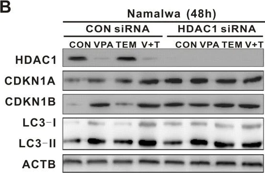 Western blot - Anti-HDAC1 antibody [EPR5517(2)] - Nuclear Loading Control (AB150399)