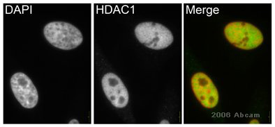 Immunocytochemistry/ Immunofluorescence - Anti-HDAC1 antibody - Nuclear Loading Control (ab19845), expandable thumbnail