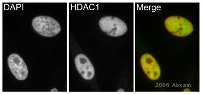 Immunocytochemistry/ Immunofluorescence - Anti-HDAC1 antibody - Nuclear Loading Control (AB19845)