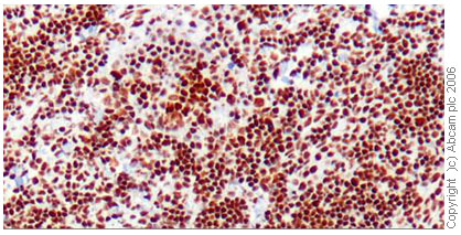 Immunohistochemistry (Formalin/PFA-fixed paraffin-embedded sections) - Anti-HDAC1 antibody - Nuclear Loading Control (ab19845), expandable thumbnail