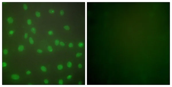 Immunocytochemistry/ Immunofluorescence - Anti-HDAC1 antibody - Nuclear Loading Control (AB53091)