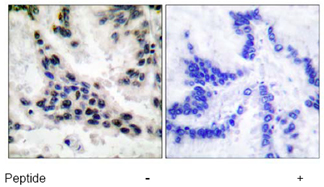 Immunohistochemistry (Formalin/PFA-fixed paraffin-embedded sections) - Anti-HDAC1 antibody (AB53091), expandable thumbnail