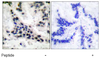 Immunohistochemistry (Formalin/PFA-fixed paraffin-embedded sections) - Anti-HDAC1 antibody - Nuclear Loading Control (AB53091)