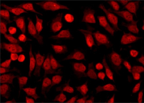 Immunocytochemistry/ Immunofluorescence - Anti-HDAC1 antibody (AB7028), expandable thumbnail