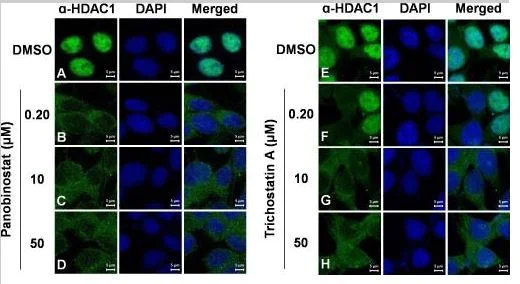 Immunocytochemistry/ Immunofluorescence - Anti-HDAC1 antibody - Nuclear Loading Control (AB7028)