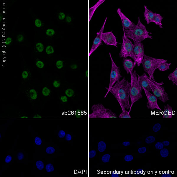 Immunocytochemistry/ Immunofluorescence - Anti-HDAC1 antibody [RM1004] (ab281585), expandable thumbnail