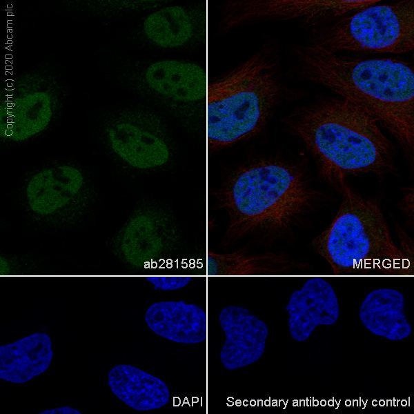 Immunocytochemistry/ Immunofluorescence - Anti-HDAC1 antibody [RM1004] (ab281585), expandable thumbnail