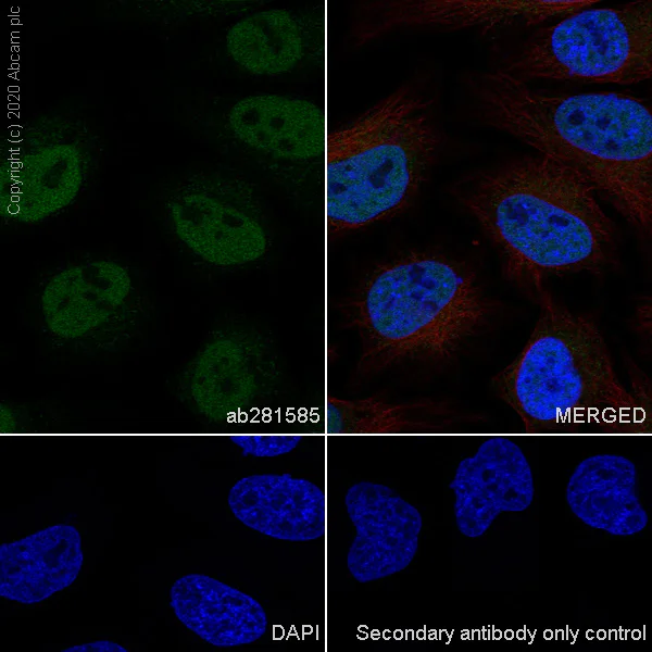 Immunocytochemistry/ Immunofluorescence - Anti-HDAC1 antibody [RM1004] - Nuclear Loading Control (AB281585)