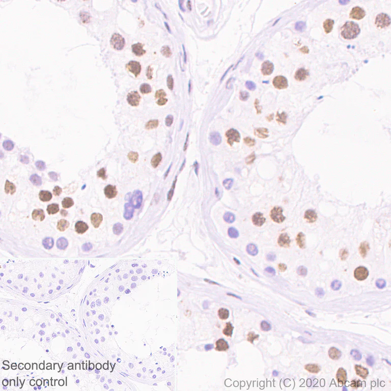 Immunohistochemistry (Formalin/PFA-fixed paraffin-embedded sections) - Anti-HDAC1 antibody [RM1004] - Nuclear Loading Control (AB281585)