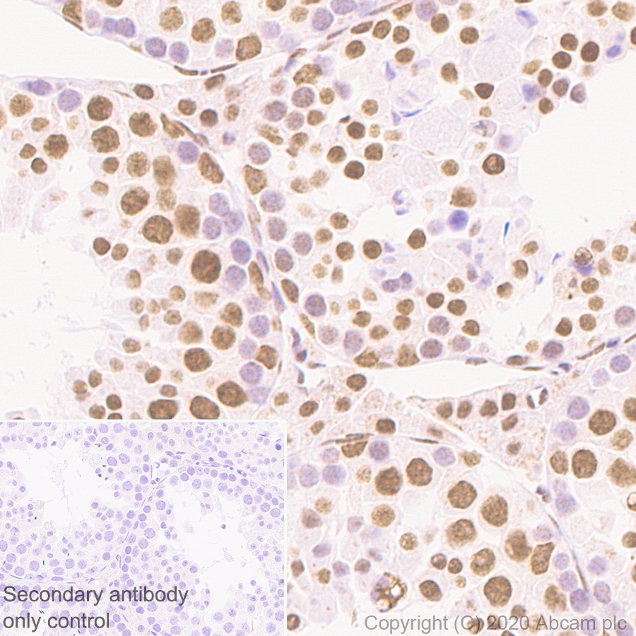 Immunohistochemistry (Formalin/PFA-fixed paraffin-embedded sections) - Anti-HDAC1 antibody [RM1004] - Nuclear Loading Control (ab281585), expandable thumbnail