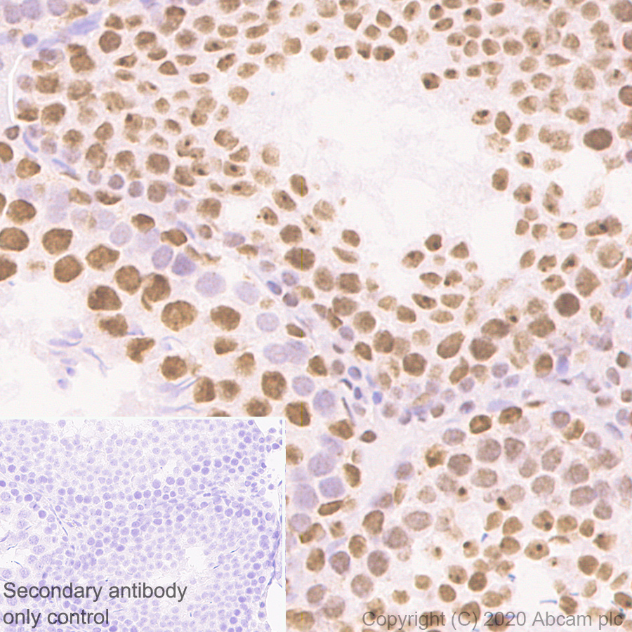 Immunohistochemistry (Formalin/PFA-fixed paraffin-embedded sections) - Anti-HDAC1 antibody [RM1004] - Nuclear Loading Control (ab281585), expandable thumbnail