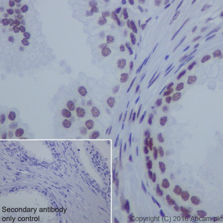 Immunohistochemistry (Formalin/PFA-fixed paraffin-embedded sections) - Anti-HDAC1 + HDAC2 antibody [EPR20327] (ab219054), expandable thumbnail