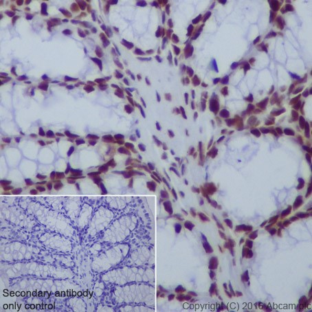 Immunohistochemistry (Formalin/PFA-fixed paraffin-embedded sections) - Anti-HDAC1 + HDAC2 antibody [EPR20327] (ab219054), expandable thumbnail