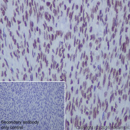 Immunohistochemistry (Formalin/PFA-fixed paraffin-embedded sections) - Anti-HDAC1 + HDAC2 antibody [EPR20327] (ab219054), expandable thumbnail