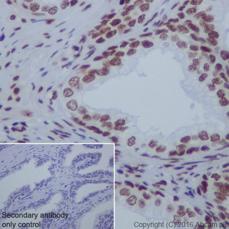 Immunohistochemistry (Formalin/PFA-fixed paraffin-embedded sections) - Anti-HDAC1 + HDAC2 antibody [EPR20327] (ab219054), expandable thumbnail