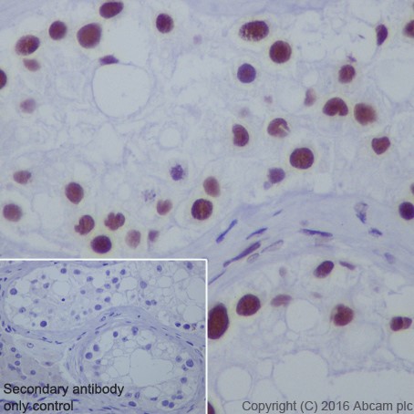 Immunohistochemistry (Formalin/PFA-fixed paraffin-embedded sections) - Anti-HDAC1 + HDAC2 antibody [EPR20327] (AB219054), expandable thumbnail