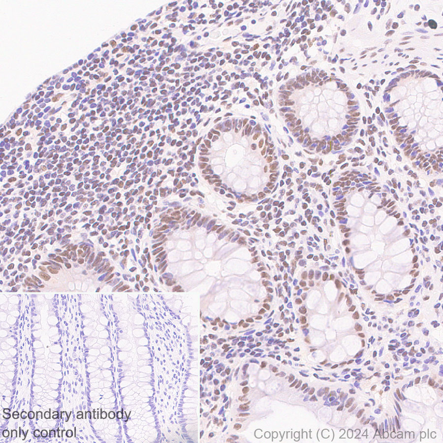 Immunohistochemistry (Formalin/PFA-fixed paraffin-embedded sections) - Anti-HDAC1 + HDAC2 + HDAC3 + HDAC8 antibody [RM1172] - BSA and Azide free (ab319060), expandable thumbnail