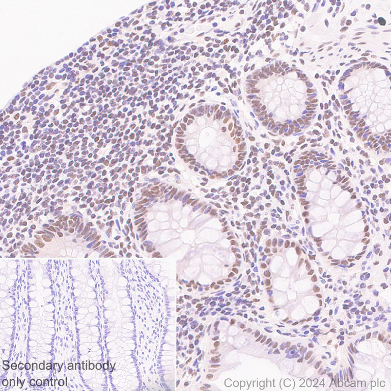 Immunohistochemistry (Formalin/PFA-fixed paraffin-embedded sections) - Anti-HDAC1 + HDAC2 + HDAC3 + HDAC8 antibody [RM1172] - BSA and Azide free (AB319060)
