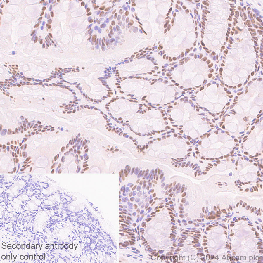 Immunohistochemistry (Formalin/PFA-fixed paraffin-embedded sections) - Anti-HDAC1 + HDAC2 + HDAC3 + HDAC8 antibody [RM1172] - BSA and Azide free (ab319060), expandable thumbnail