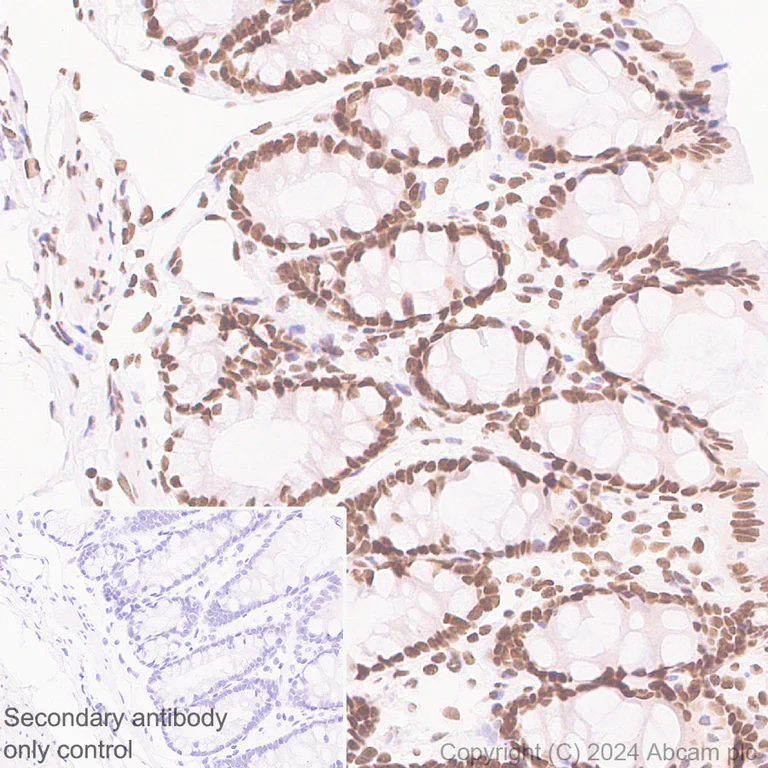 Immunohistochemistry (Formalin/PFA-fixed paraffin-embedded sections) - Anti-HDAC1 + HDAC2 + HDAC3 + HDAC8 antibody [RM1172] - BSA and Azide free (AB319060)