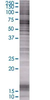 SDS-PAGE - HDAC1 overexpression 293T lysate (whole cell) (AB94165)