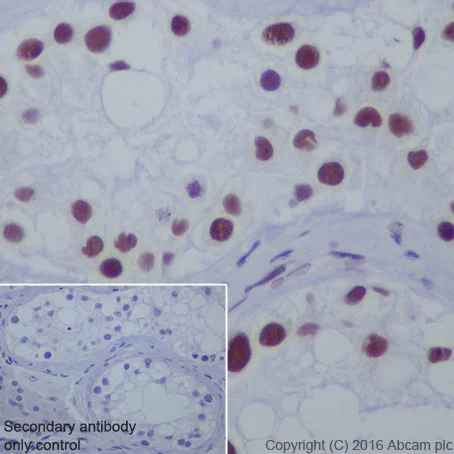 Immunohistochemistry (Formalin/PFA-fixed paraffin-embedded sections) - Anti-HDAC1+HDAC2 antibody [EPR20327] - BSA and Azide free (AB251562)
