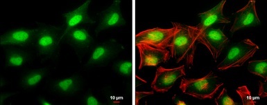 Immunocytochemistry/ Immunofluorescence - Anti-HDAC2 antibody (AB137364)
